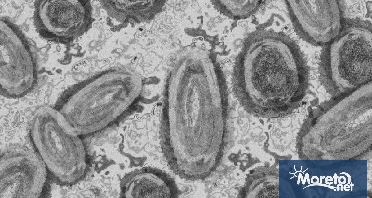 Първи случай на маймунска шарка беше потвърден в Румъния съобщи