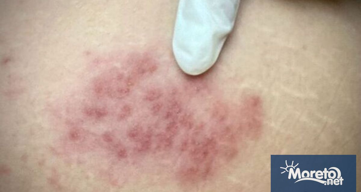 Румънското министерство на здравеопазването съобщи днес че е поставена първата