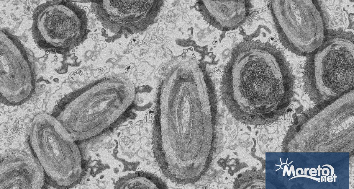 Разпространението на маймунската шарка в Австралия от четвъртък се счита