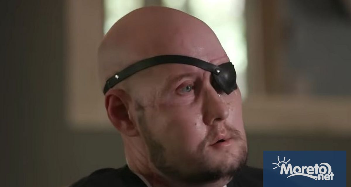 Хирурзи в Ню Йорк съобщиха че са извършили първата в