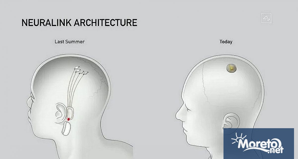Технологичният милиардер Илон Мъск заяви че неговата компания Neuralink успешно