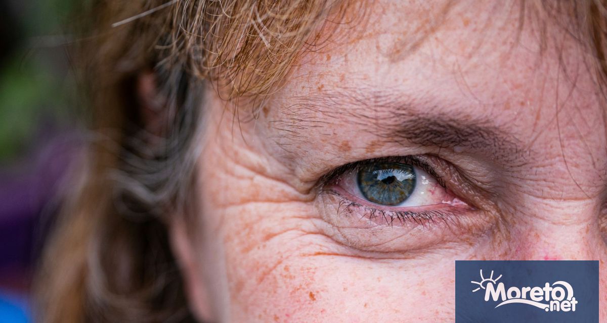 Да остаряваме грациозно означава да приемем бръчките които животът е