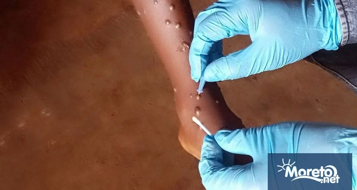 Световната здравна организация съобщи че е одобрила използването на първия