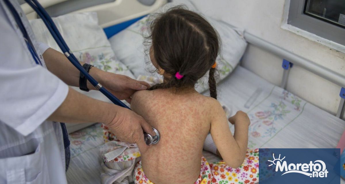 Морбилите се завръщат и това е сигнал за събуждане