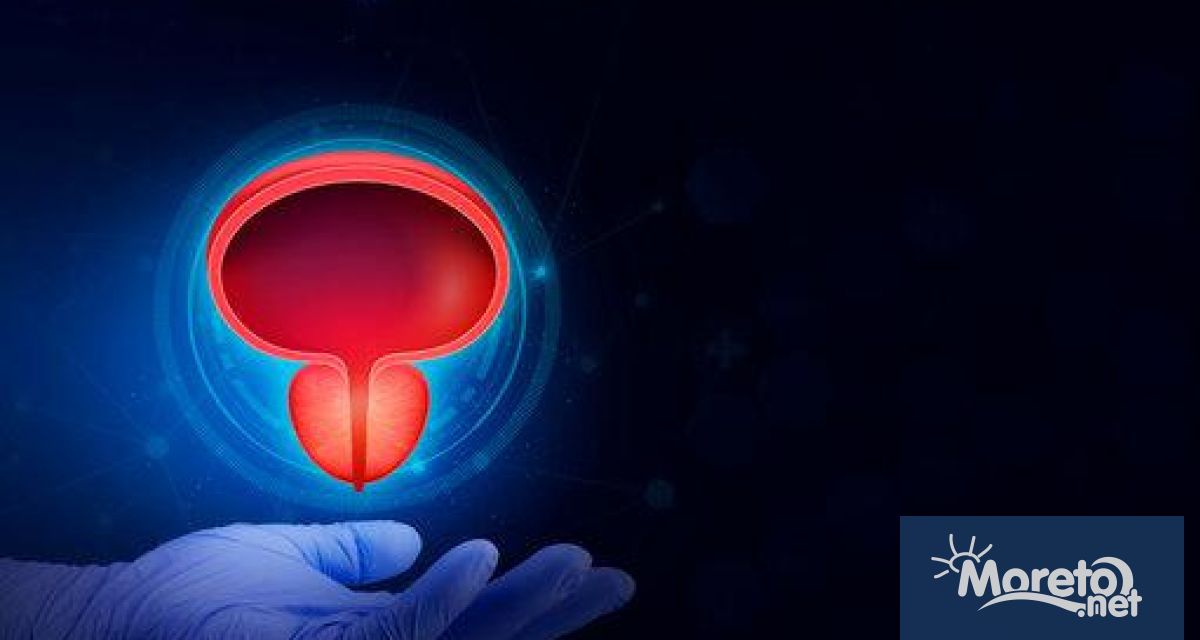 Когато стане дума за простата мъжете имат много какво да