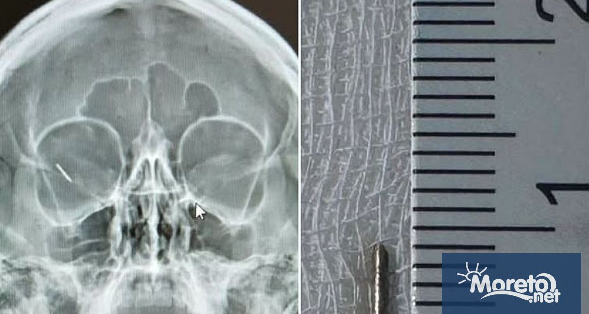 Екипът на Очна клиника към УМБАЛ Александровска в столицата извърши