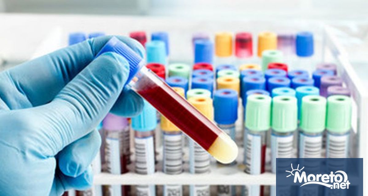 Безплатно и анонимно изследване за ХИВ статуса ще се проведе