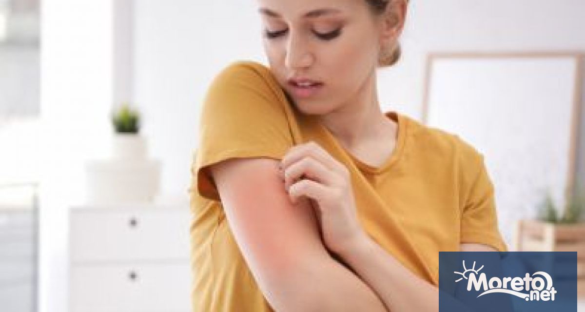 Национална кампания за безплатни прегледи и тестване за кожни алергии